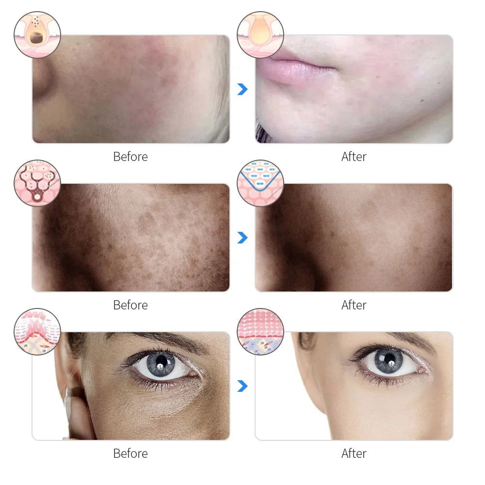 Professional LED Facial Mask
